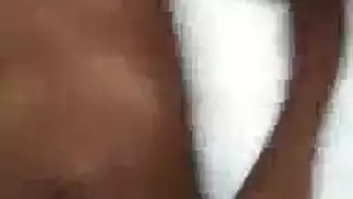 التبول الملبس الثدي أبيض